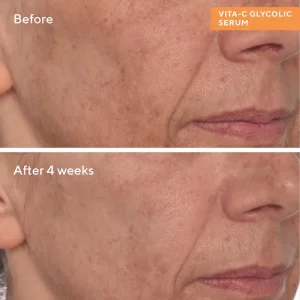 پک روشن کننده و ضد لک