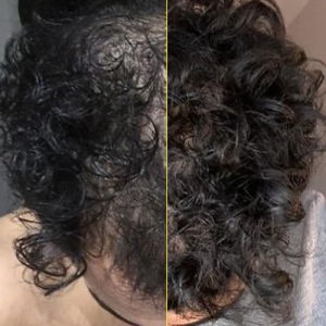 سرم ضد ریزش مو و افزایش ضخامت مو ۶۰ میل برند dense