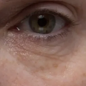 ترمیم کننده دور چشم پپتاید15 میل برند المیس