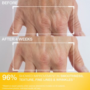 کرم روشن کننده  و سفت کننده پوست دست استری وکتین