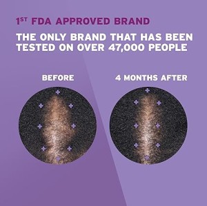 فوم ماینوکسیدل 5%ضد ریزش و درمان نازک شدن مو  بانوان برندروگین rogaine