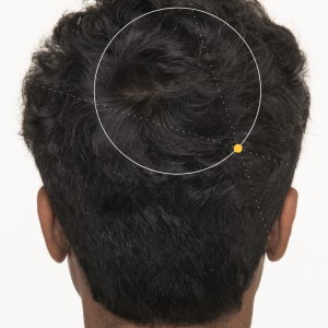 ضد ریزش و رشد مجدد مو مردانه ۱۲۰ عددی برند نوترافول