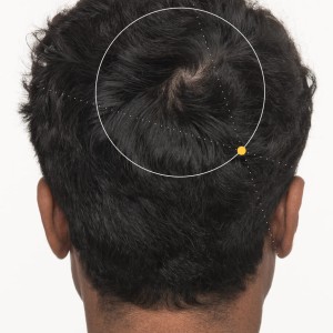 ضد ریزش و رشد مجدد مو مردانه ۱۲۰ عددی برند نوترافول