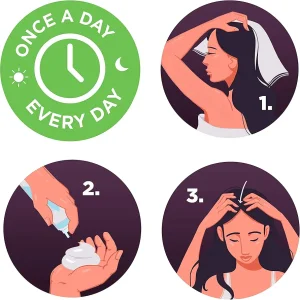 فوم ماینوکسیدیل ۵%ضد ریزش و پرپشت کننده مو مخصوص  بانوان تک قوطی