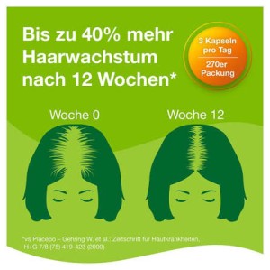 مکمل گیاهی ضد ریزش مو و رشد مجدد مو ۲۷۰ عددی برند پریورین