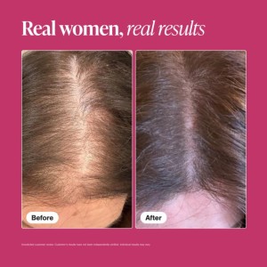 مکمل ریزش مو ویویسکال مخصوص بانوان ۱۸۰عددی ساخت آمریکا Viviscal, Extra Strength Hair Nourishment System Supplement