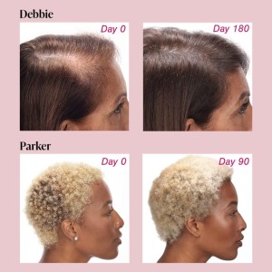 مکمل ریزش مو ویویسکال مخصوص بانوان ۱۸۰عددی ساخت آمریکا Viviscal, Extra Strength Hair Nourishment System Supplement