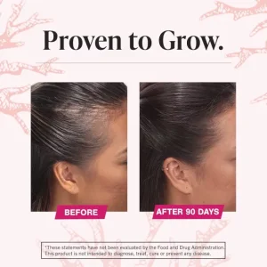 مکمل ریزش مو ویویسکال مخصوص بانوان ۱۸۰عددی ساخت آمریکا Viviscal, Extra Strength Hair Nourishment System Supplement