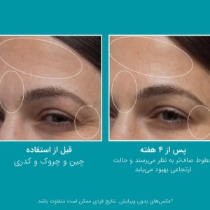 کرم مرطوب کننده  Peptide Skinjection پیتر توماس روث ۵۰ میل