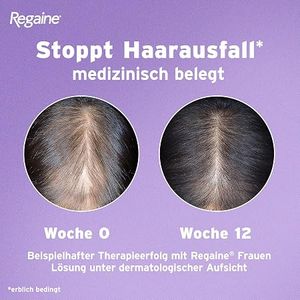 فوم ماینوکسیدیل ۵%ضد ریزش و پرپشت کننده مو مخصوص  بانوان برند regaine