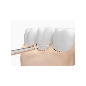 دستگاه شستشوی دهان و دندان واتر جت شیائومی میجیا  X IAOMI MIJIA MEO705