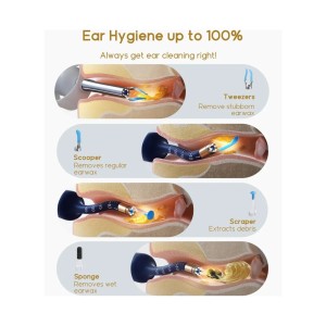 گوش پاک کن هوشمند بی برد شیائومی  Bebird Earsight Plus I35R