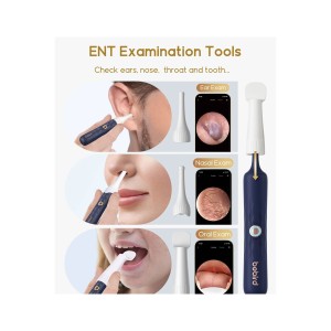 گوش پاک کن هوشمند بی برد شیائومی  Bebird Earsight Plus I35R