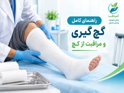 راهنمای کامل گچ‌ گیری و مراقبت از گچ