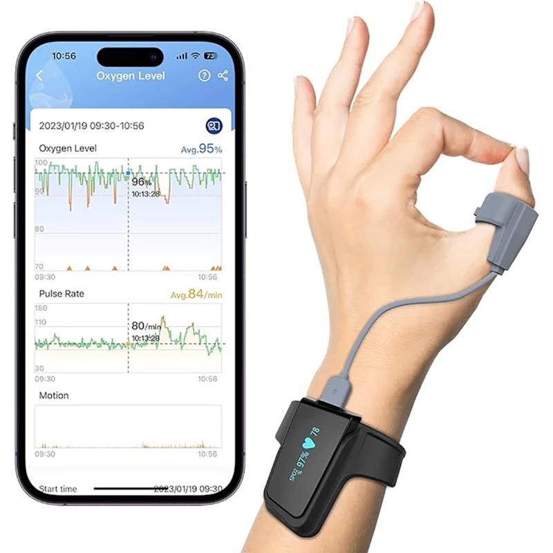 پالس اکسیمتر مچی هوشمند ویاتوم Checkme O2 Max