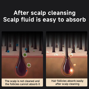 شانه ارتعاشی نور درمانی قرمز شیائومی برای تحریک رشد مو