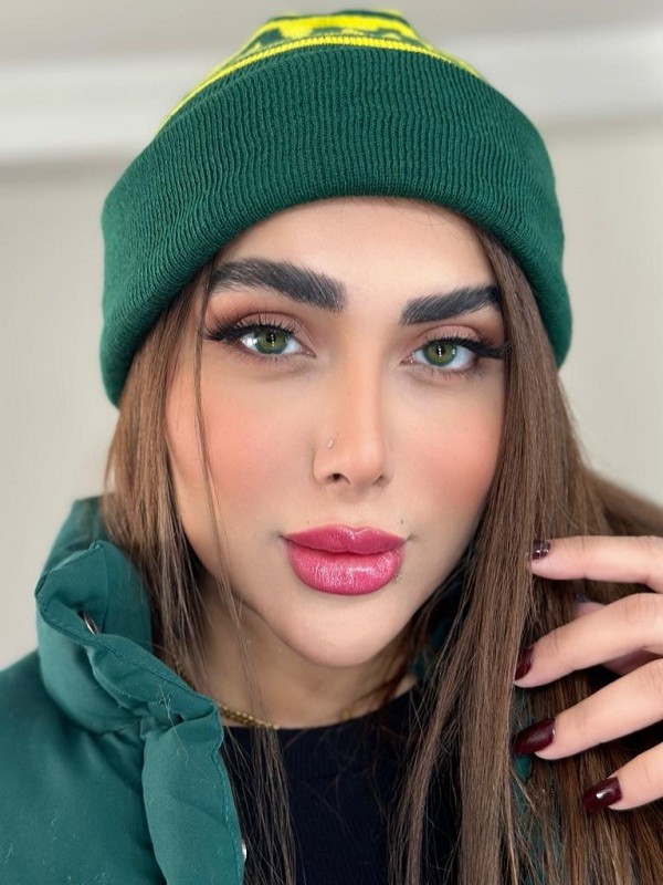 لنز رنگی وید گیرین (Weed Green) برند یونیک (Unique)