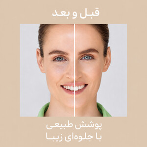 ضد آفتاب صورت رنگی آیسدین