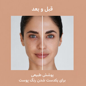 قبل و بعد کرم ضد آفتاب رنگی آیسدین