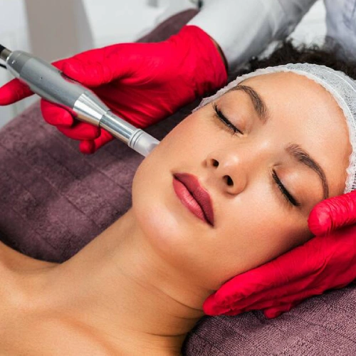 پی آر پی کیت VIP صورت