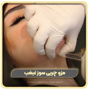 مزو چربی سوز