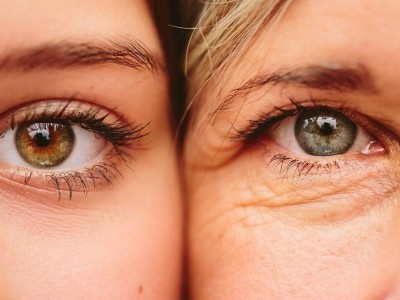ترفندهای ساده برای کاهش چین و چروک دور چشم بدون دستگاه