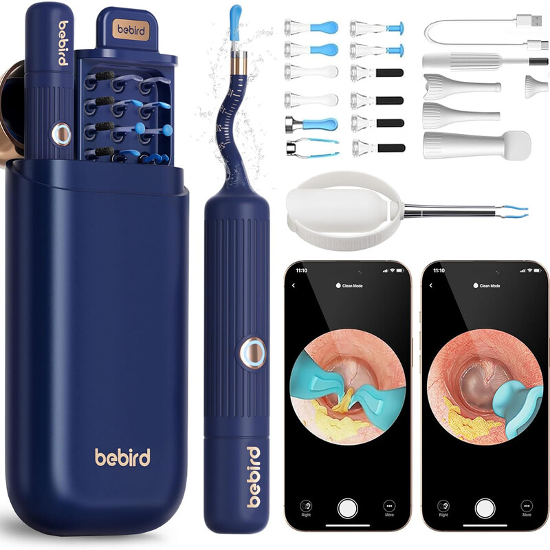 دستگاه آندوسکوپی و پاک کننده داخل گوش شیائومی مدل Xiaomi I35R