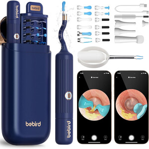 دستگاه آندوسکوپی و پاک کننده داخل گوش شیائومی Xiaomi مدل I35R