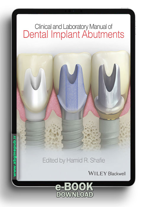 CLINICAL AND LABORATORY MANUAL OF DENTAL IMPLANT ABUTMENTS