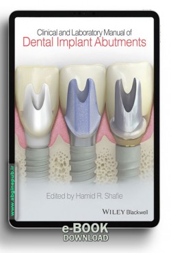 CLINICAL AND LABORATORY MANUAL OF DENTAL IMPLANT ABUTMENTS