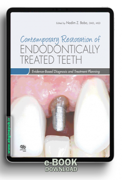 Contemporary Restoration of Endodontically Treated Teeth Evidence-Based Diagnosis and Treatment Planning