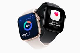 Apple Watch Series 11
