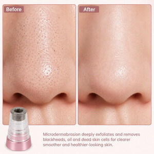 میکرودرم خانگی روزینکس مدل SOFT SKIN