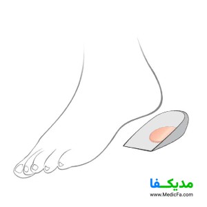 پد خار پاشنه اتسی مدل TH022