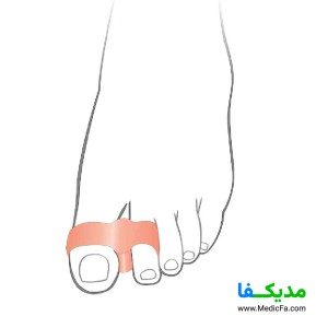 پد فاصله دهنده دو انگشتی اتسی مدل TF05