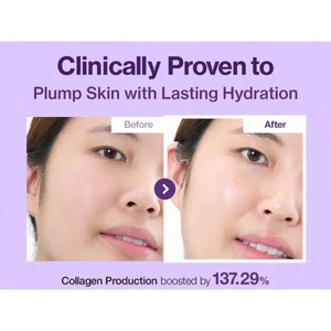 تووونر نامبوزین