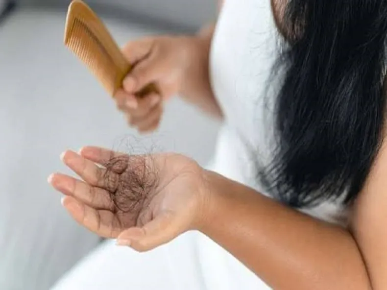 دلایل ریزش مو در زنان
