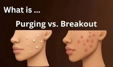 پورجینگ 