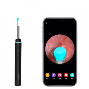 گوش پاک کن هوشمند شیائومی Bebird Smart Visual Ear Pick M9s