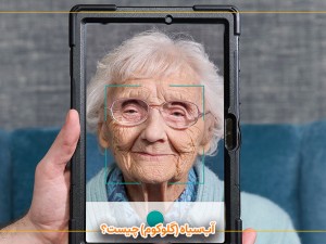 آب‌سیاه (گلوکوم) چیست؟