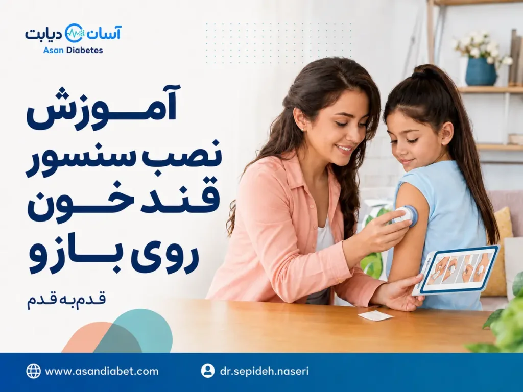 نصب سنسور قند خون روی بازو | آموزش کامل و نکات