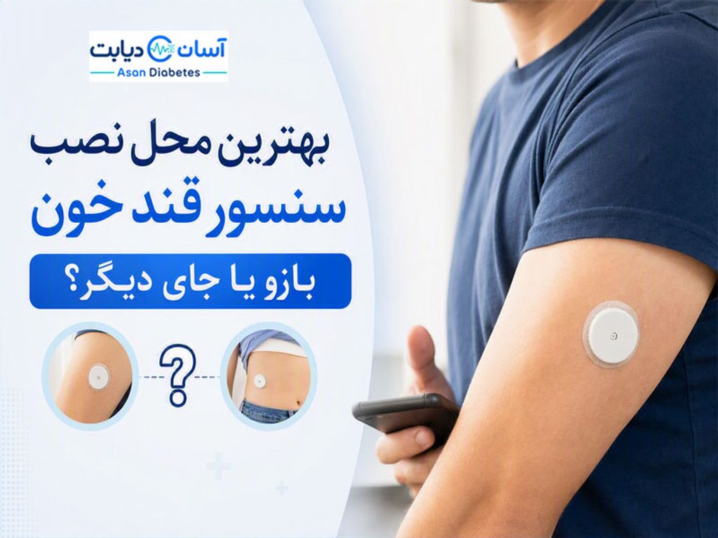 بهترین محل نصب سنسور قند خون | بازو یا جای دیگر؟