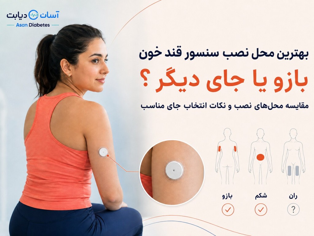 بهترین محل نصب سنسور قند خون | بازو یا جای دیگر؟