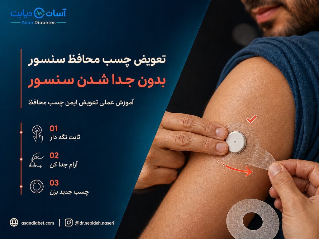 تعویض چسب محافظ سنسور بدون جدا شدن سنسور | آموزش عملی