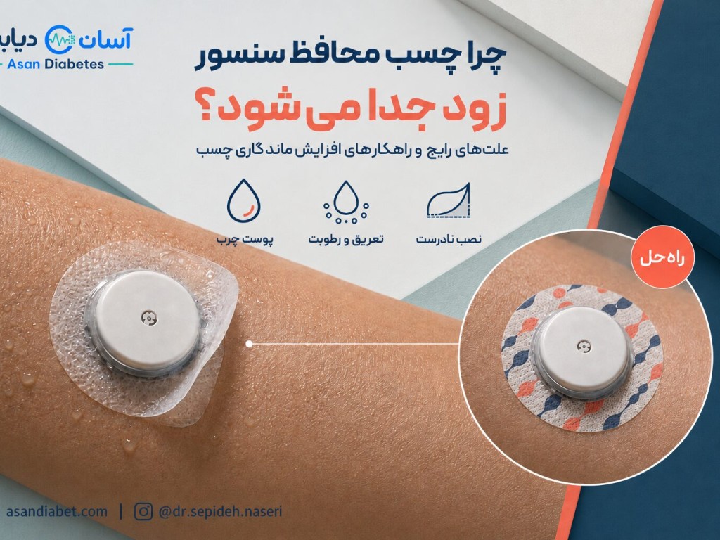 چرا چسب محافظ سنسور زود جدا می‌شود؟ | علت و راه‌حل