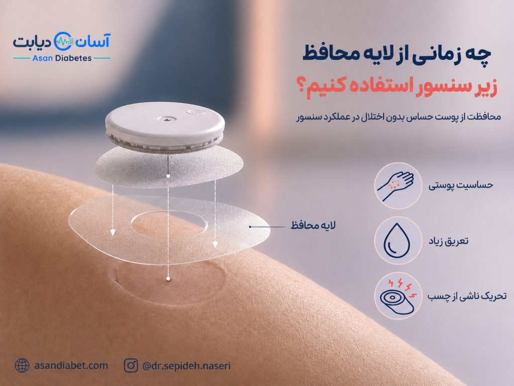 چه زمانی از لایه محافظ زیر سنسور استفاده کنیم؟ | لایه محافظ زیر سنسور