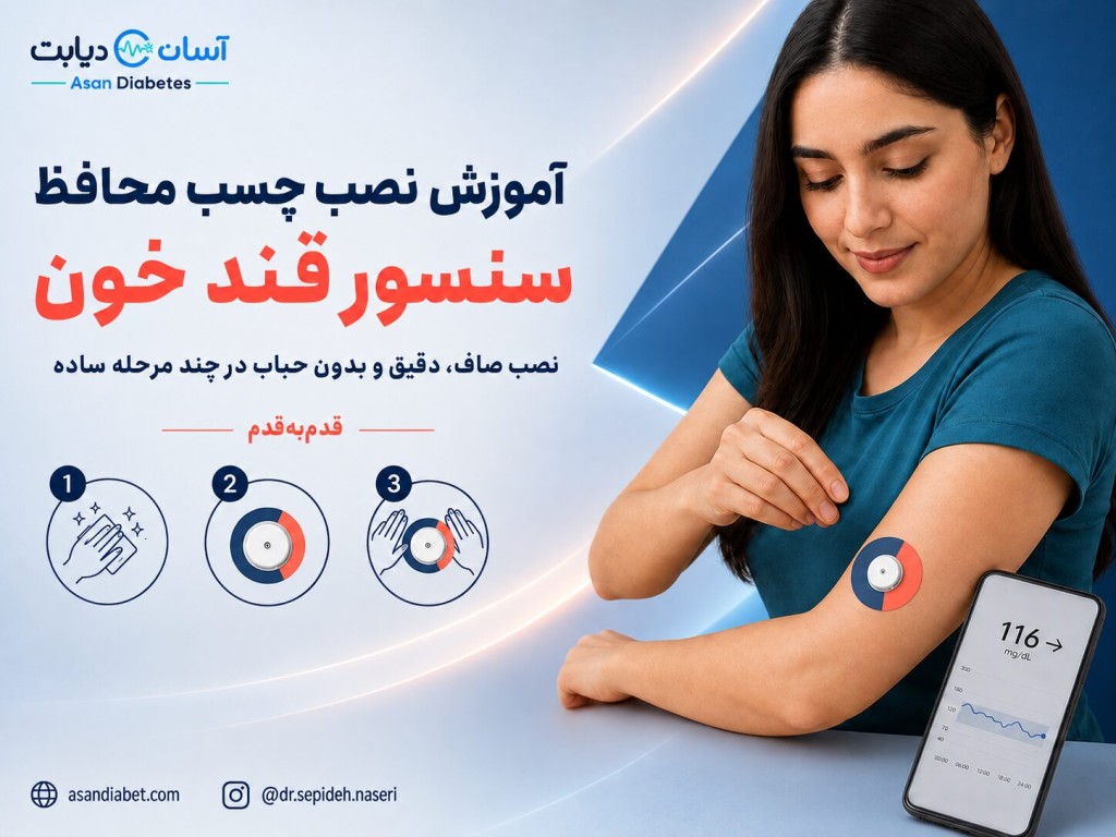 آموزش نصب چسب محافظ سنسور | قدم‌به‌قدم