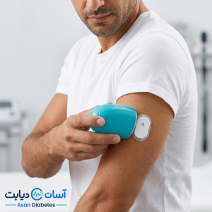 سنسور پایش مداوم قند خون سایبایونیکس (Sibionics) مدل GS1