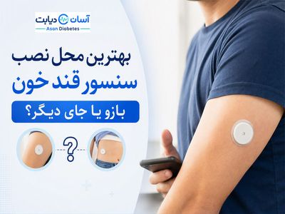 بهترین محل نصب سنسور قند خون | بازو یا جای دیگر؟