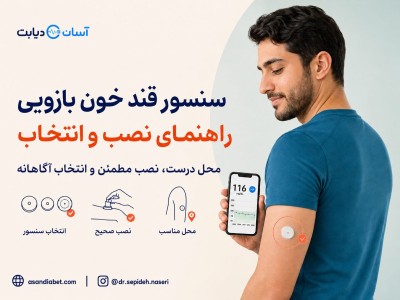 سنسور قند خون بازویی | راهنمای نصب و انتخاب